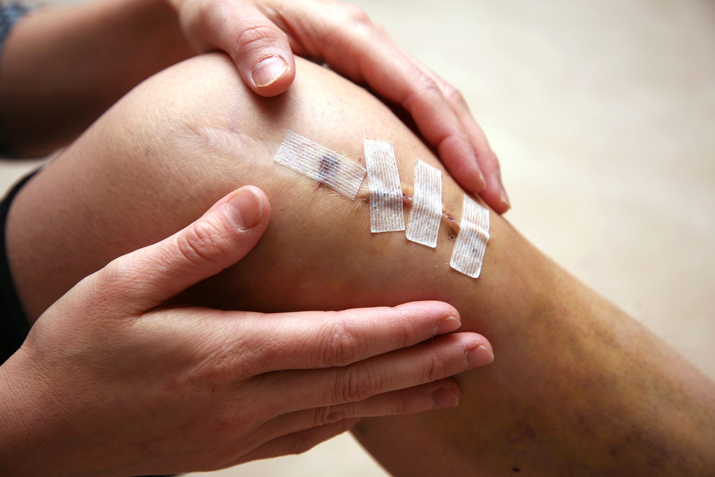 person with bandaged knee