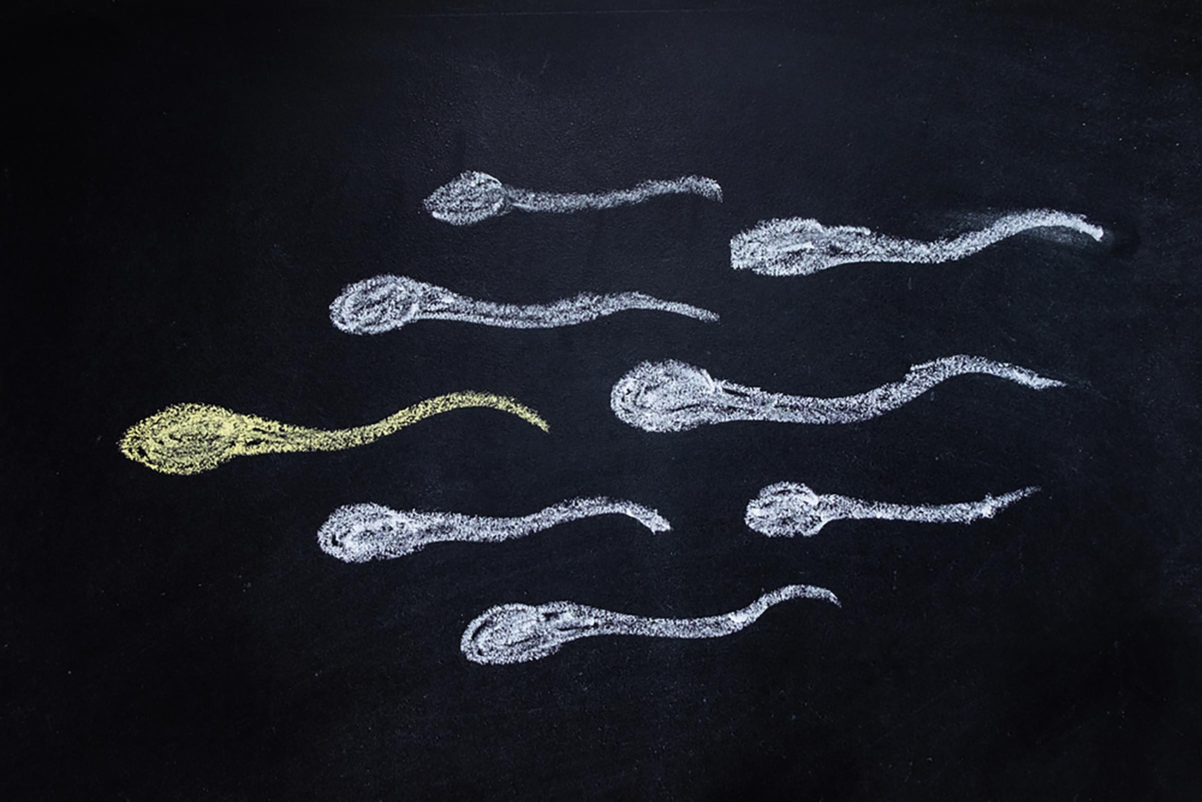 infertility