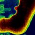 "Here's How I Knew I Had an Ulcer": A Patient's Story, with a Gastro Doctor's Wisdom